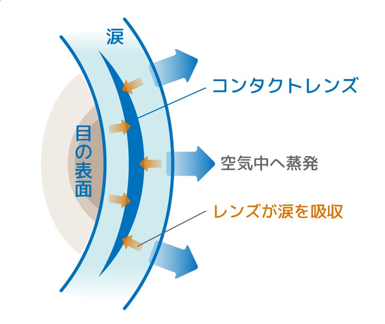 ドライアイにおすすめのコンタクトレンズは？【ドライアイ原因と対処法も解説】 | コンタクトレンズ激安通販 │アットコンタクト