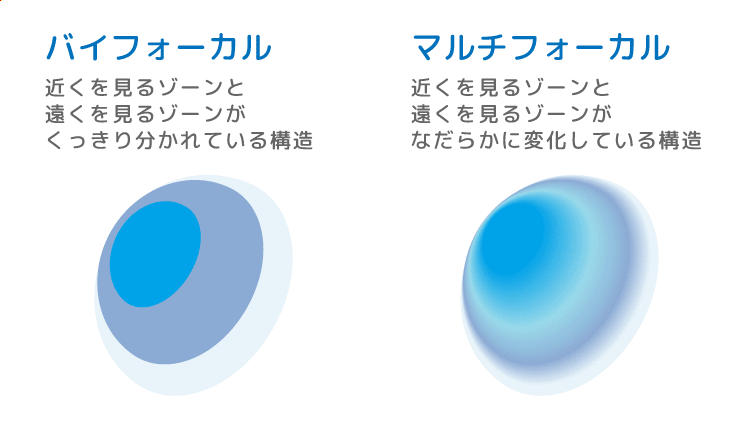 コンタクトレンズで近くが見えない 原因とコンタクトレンズの正しい選び方 コンタクトレンズ激安通販 アットコンタクト