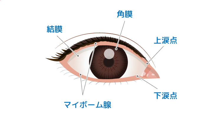 コンタクトレンズの白い汚れの原因は 対処法と汚れにくい商品を紹介 コンタクトレンズ激安通販 アットコンタクト