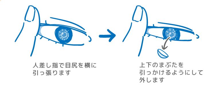 コンタクトレンズの付け方とうまく入れるコツを解説 初心者でも簡単 コンタクトレンズ激安通販 アットコンタクト